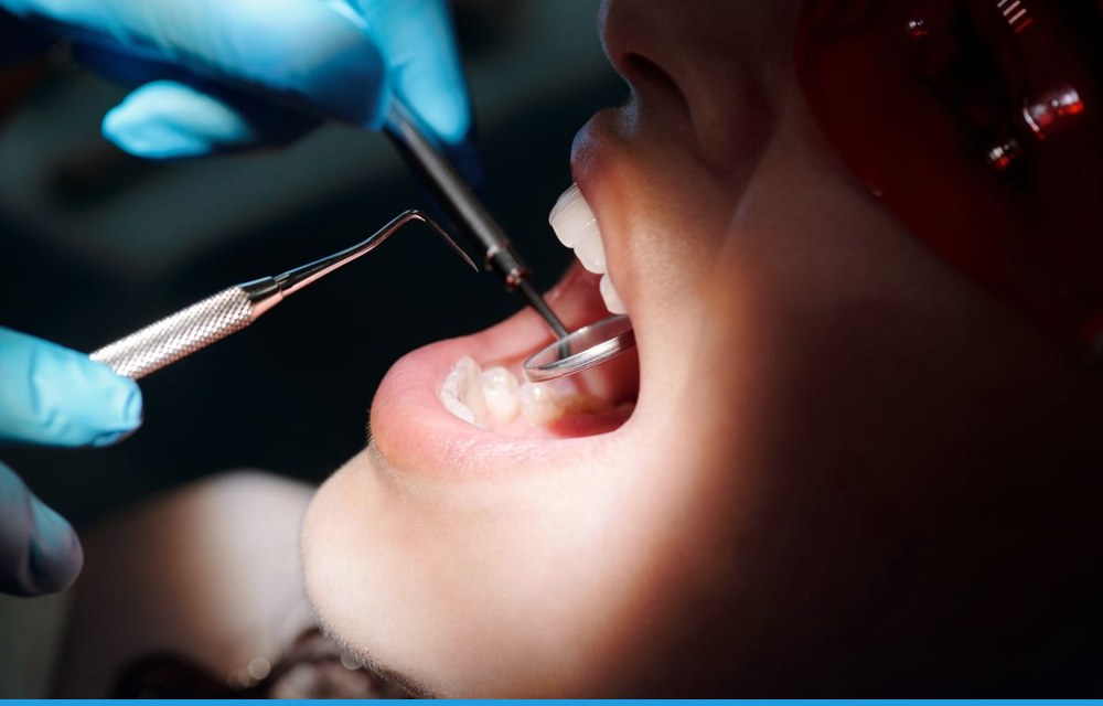 All-on-4: una arcada completa de dientes fijos