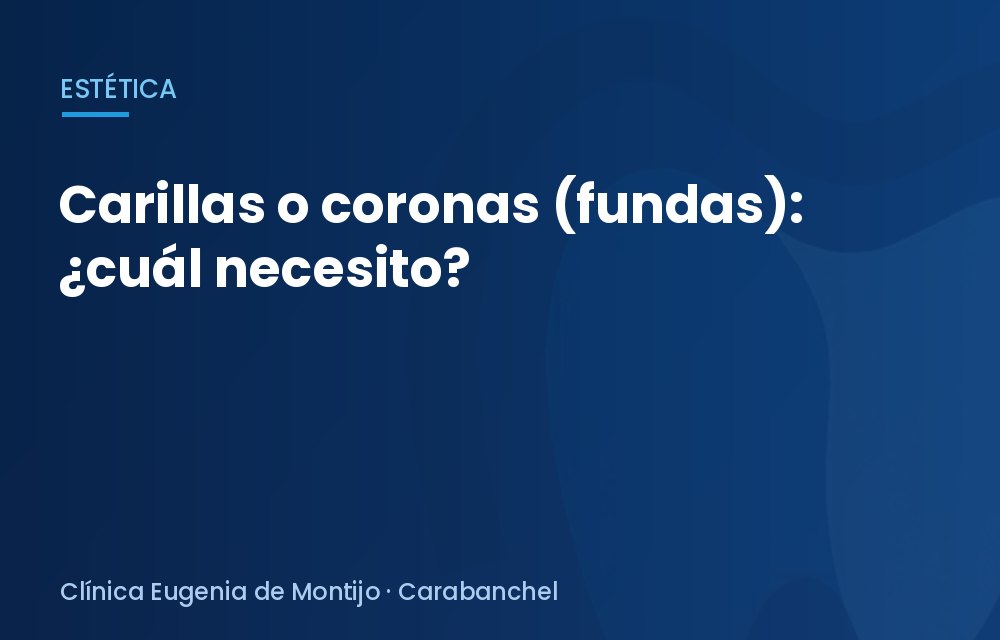 Carillas o coronas (fundas): ¿cuál necesito?