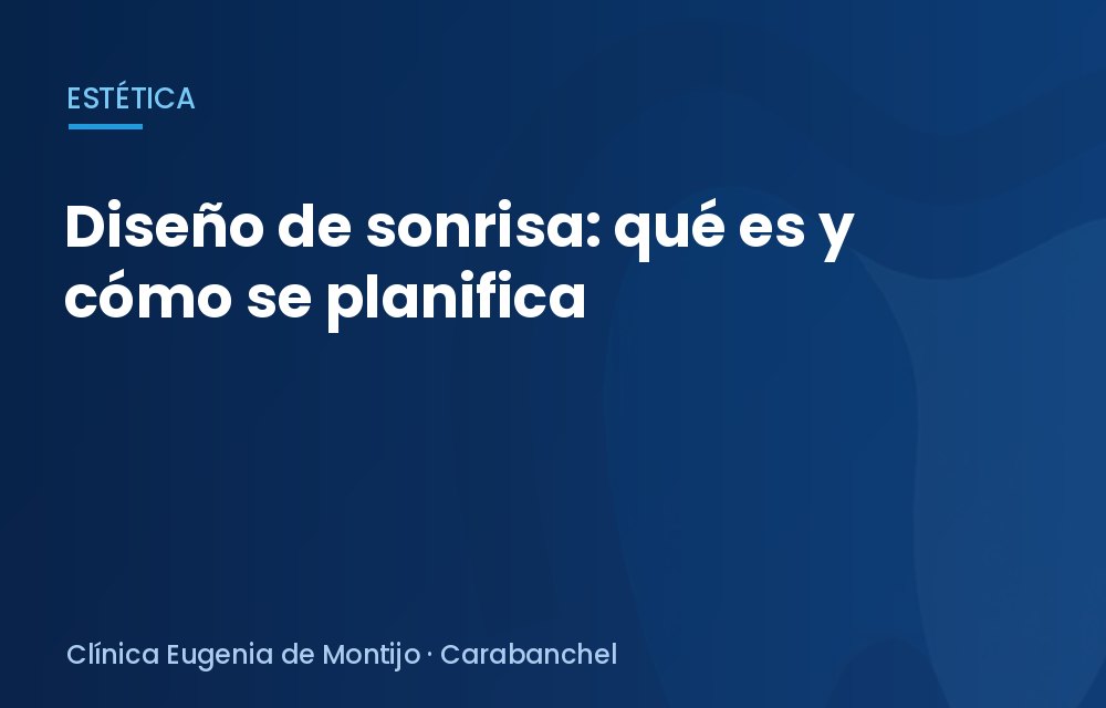 Diseño de sonrisa: qué es y cómo se planifica