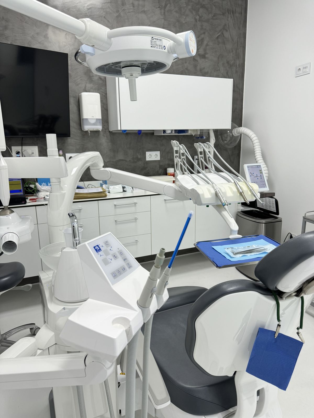 Encías que sangran: gingivitis y cómo frenarla