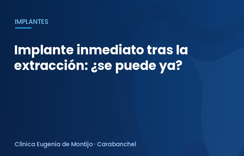 Implante inmediato tras la extracción: ¿se puede ya?