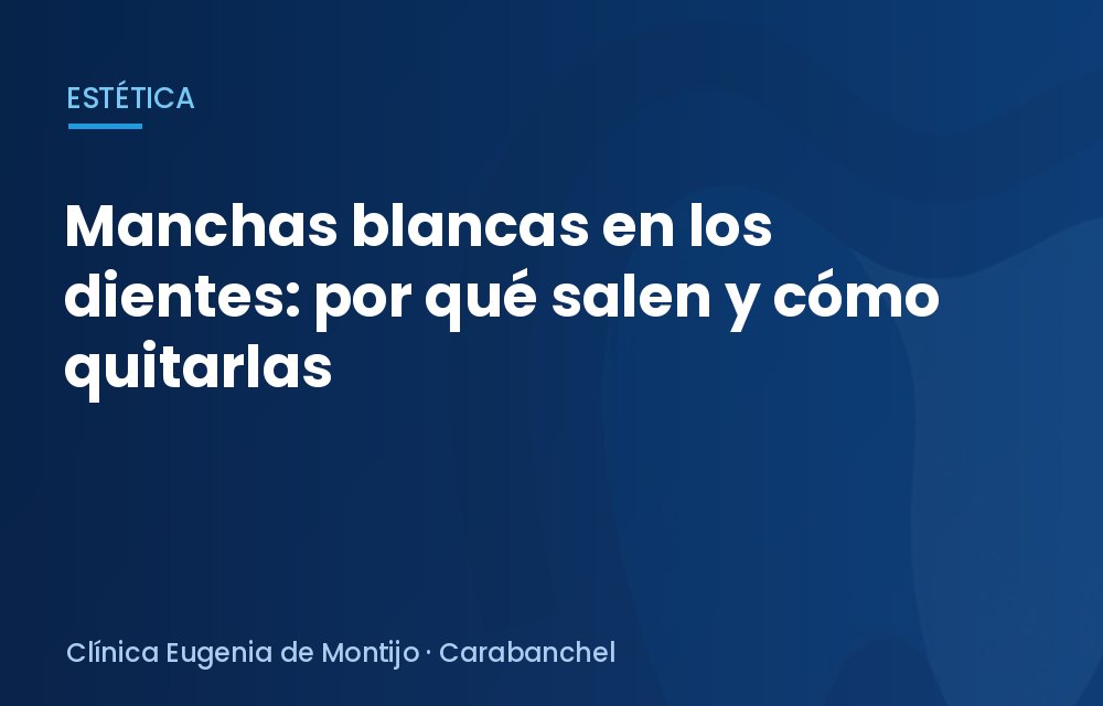 Manchas blancas en los dientes: por qué salen y cómo quitarlas