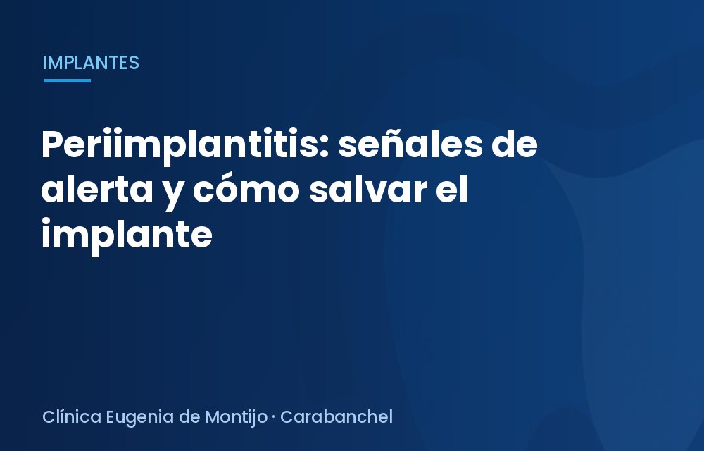 Periimplantitis: señales de alerta y cómo salvar el implante